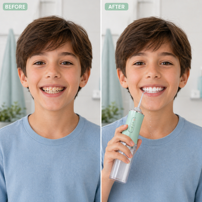 Portable Water Flosser – Deep Clean Anywhere